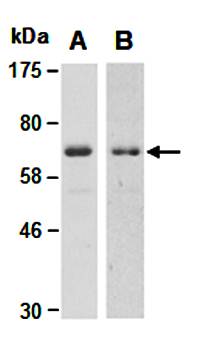 PIAS1 (C) Antibody, Mouse Monoclonal