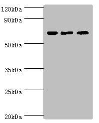 PIAS2 Antibody