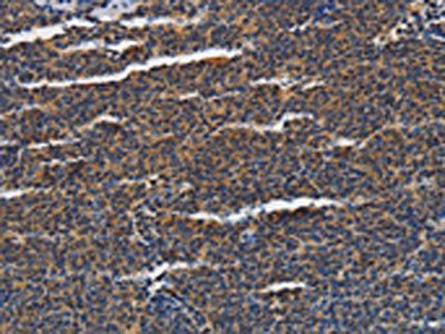 PIAS2 Antibody