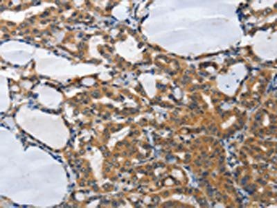 PIAS2 Antibody