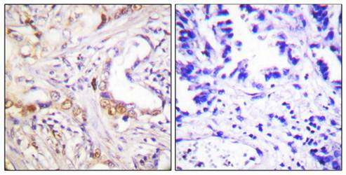 PIAS3 Antibody
