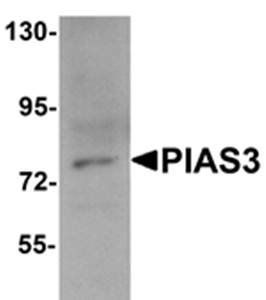 PIAS3 Antibody