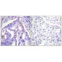 PIAS4 Antibody