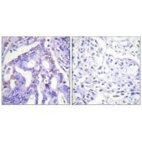 PIAS4 antibody