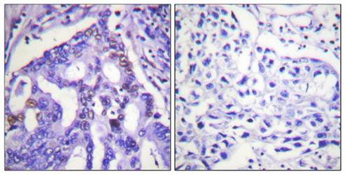PIAS4 Antibody