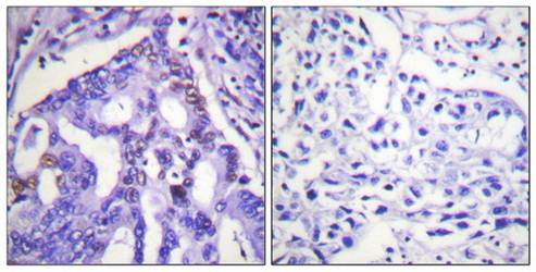 PIAS4 antibody