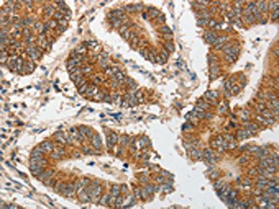 PIBF1 Antibody