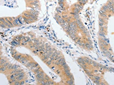 PIBF1 Antibody