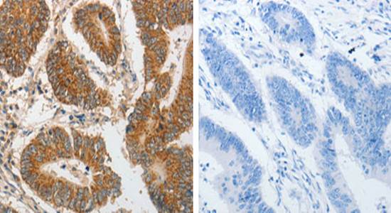 PIBF1 Rabbit Polyclonal Antibody
