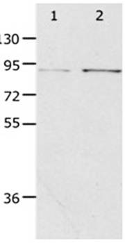 PIBF1 Rabbit Polyclonal Antibody