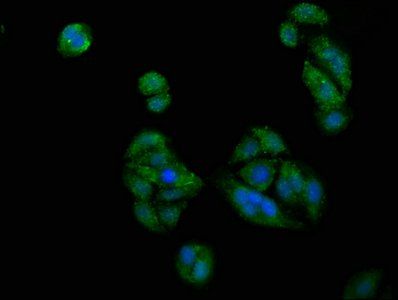 PICALM Antibody