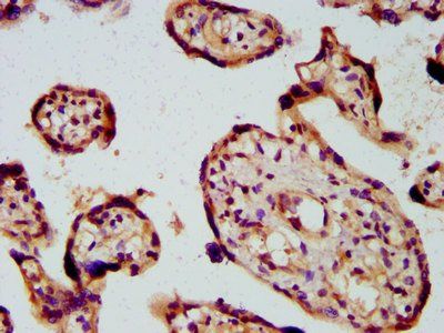 PICALM Antibody