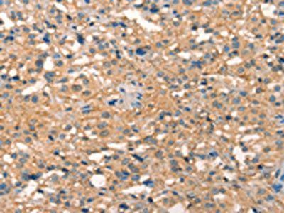 PICK1 Antibody