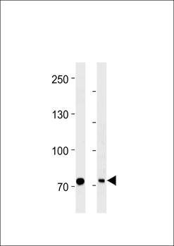 PID/MTA2 antibody