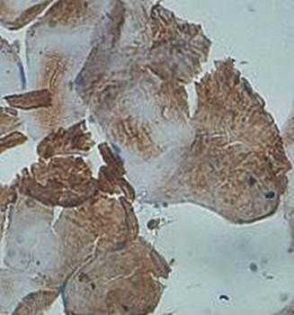 PID1 Rabbit Polyclonal Antibody
