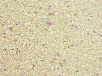 PIEZO1 Antibody