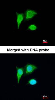 PIG3 antibody