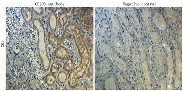 CD206 antibody