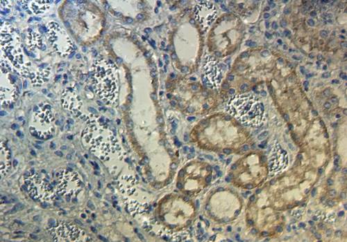CD206 antibody