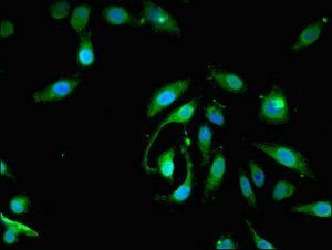 PIGA Antibody