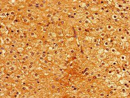 PIGA Antibody