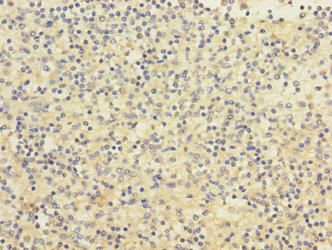 PIGL Antibody