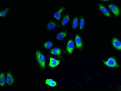 PIGO Antibody