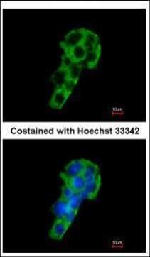 PIGR antibody [N2C1], Internal