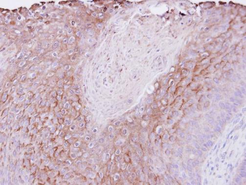 PIGR antibody [N2C1], Internal