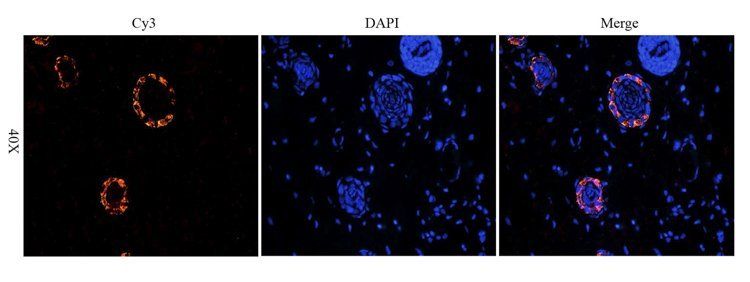PIGR antibody
