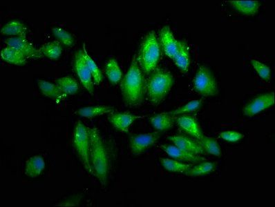 PIGV Antibody