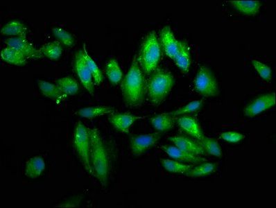 PIGV antibody