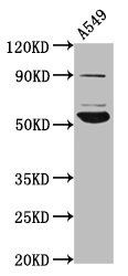 PIGV antibody