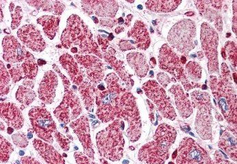 Goat anti-PIK3C2A Antibody