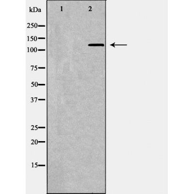 PIK3CA Antibody