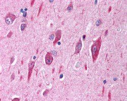 PIK3CA/P110alpha Antibody