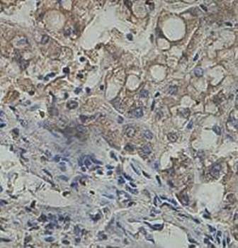 PIK3CB Rabbit Polyclonal Antibody