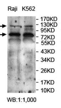 PIK3CB Rabbit Polyclonal Antibody