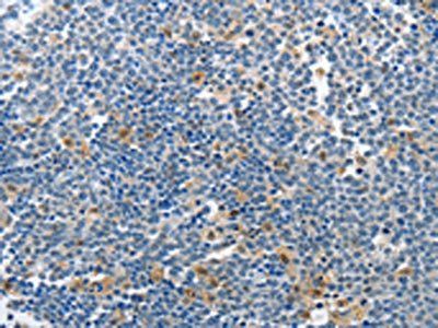 PIK3R2 antibody