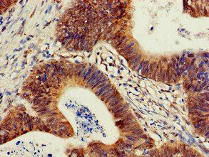 PIK3R2 Antibody
