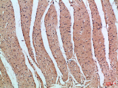 PIK3R2 antibody