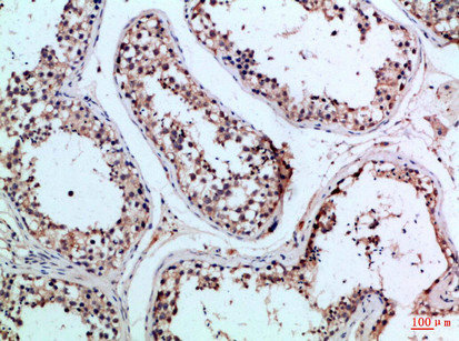 PIK3R2 antibody