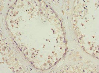 PIK3R3 Antibody