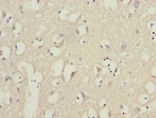 PIK3R3 Antibody