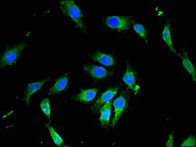 PIK3R4 Antibody