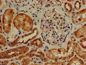 PIK3R4 Antibody