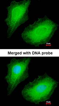 p150(PIK3R4) antibody