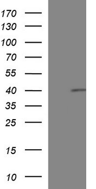 PIK3R5 Antibody