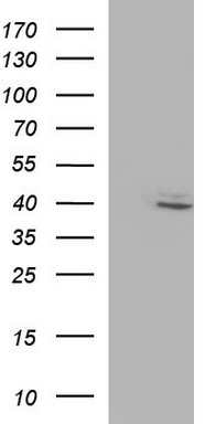 PIK3R5 Antibody