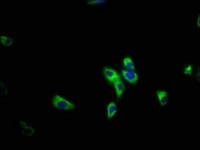 PIK3R5 antibody